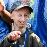 Sammy Basso, the boy from Veneto who made Progeria Syndrome known worldwide