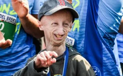 Sammy Basso, the boy from Veneto who made Progeria Syndrome known worldwide