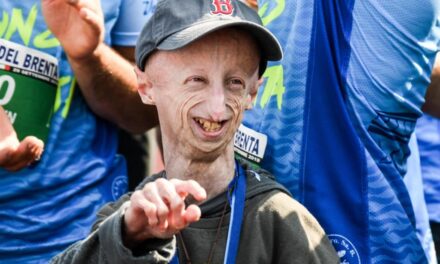 Sammy Basso, the boy from Veneto who made Progeria Syndrome known worldwide